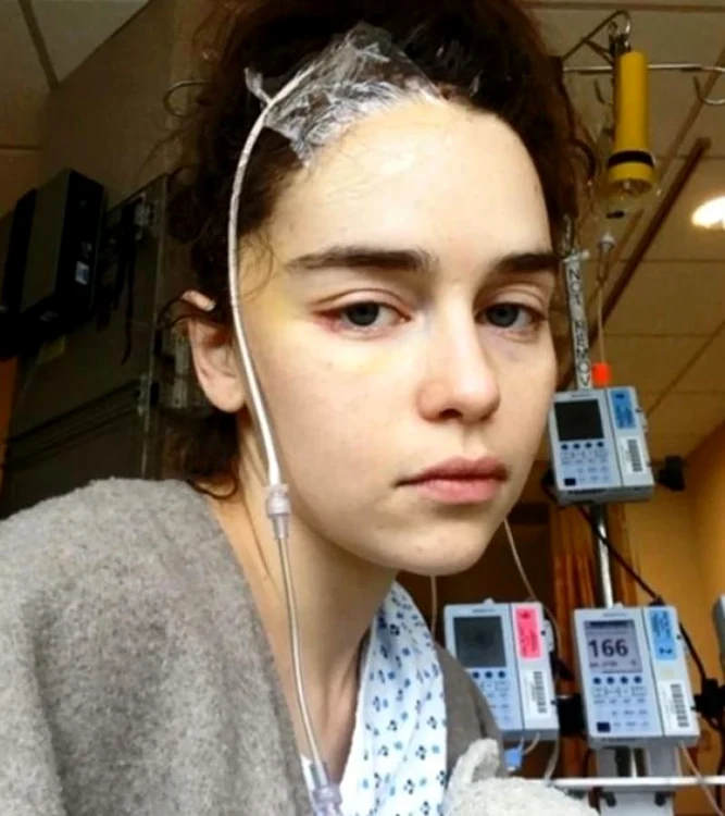 Emilia Clarke a fost operată pe creier