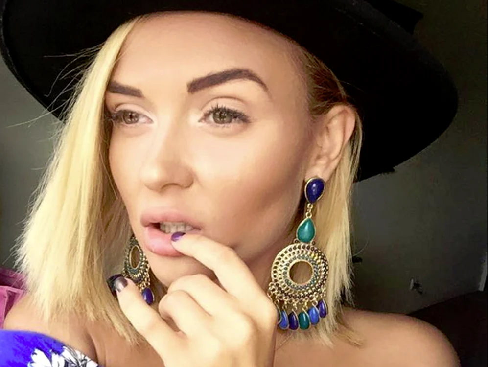 Oana Radu (21 de ani) a ajuns pe masa de operație a chirurgului estetician după ce a slăbit drasticfoto: Arhiva Personală