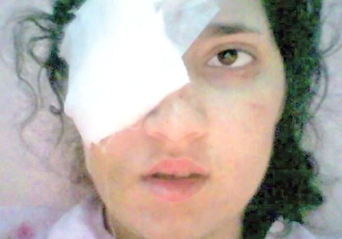 Daniela Borz a rămas cu sechele pe viață