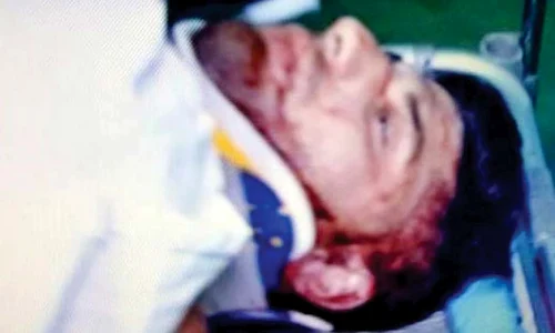 Tânărul de  23 de ani a suferit  multiple fracturi jpeg
