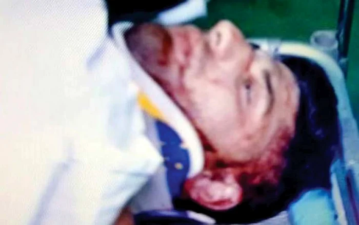 Tânărul de  23 de ani a suferit  multiple fracturi