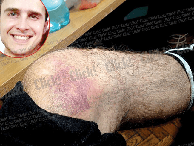 Content image