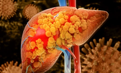 e198c3b9cb1dec572711afe8c8ee096e8c jpg