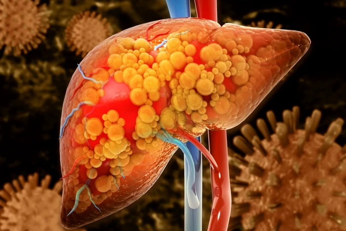 e198c3b9cb1dec572711afe8c8ee096e8c jpg