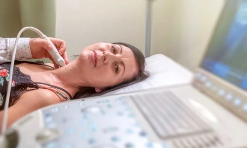 ecografie tiroida jpg