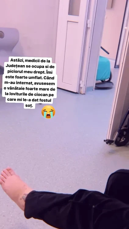 Piciorul Danei Roba este extrem de umflat / foto: arhivă personală