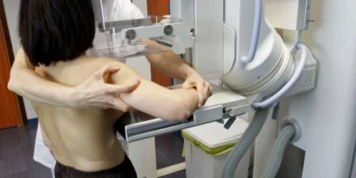 În unele cazuri, mamografia se realizează începând de la 25-30 de ani