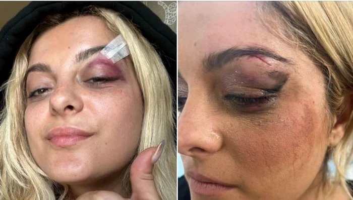Imaginile postate de vedetă pe Facebook. FOTO Facebook Bebe Rexha's Private Page