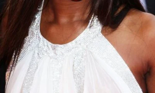 vedete care au probleme cu caderea parului naomi campbell jpeg