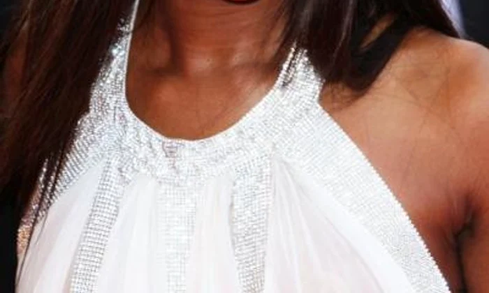 vedete care au probleme cu caderea parului naomi campbell jpeg