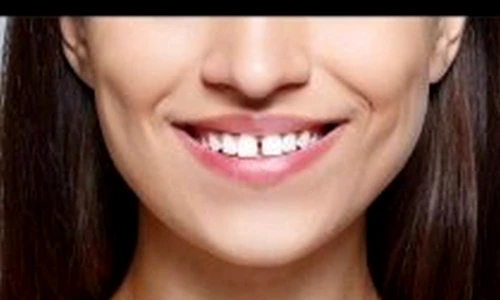 1 73836 original jpg jpeg