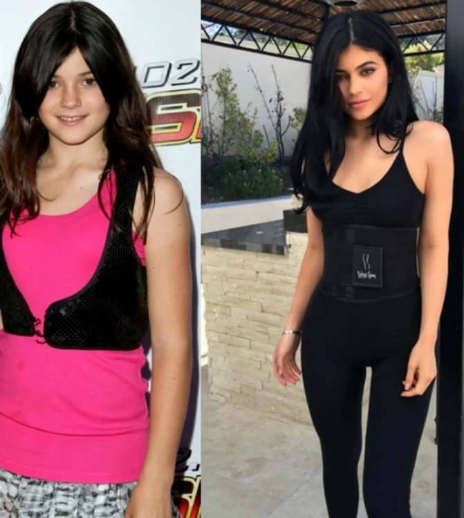 Kylie Jenner, 2008 (foto stânga) vs. 2015 (foto dreapta)