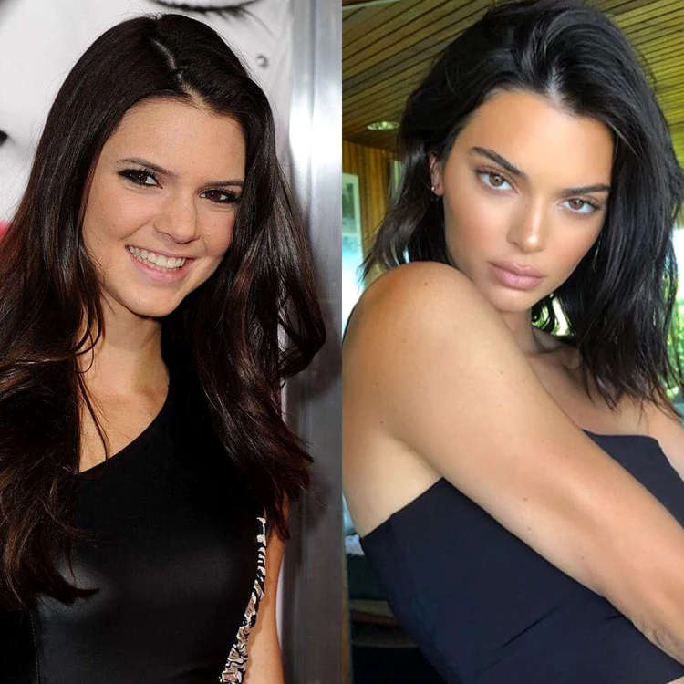 Deși se spune că ea ar fi cea mai „naturală” membră a familiei, și transformarea lui Kendall este vizibilă 