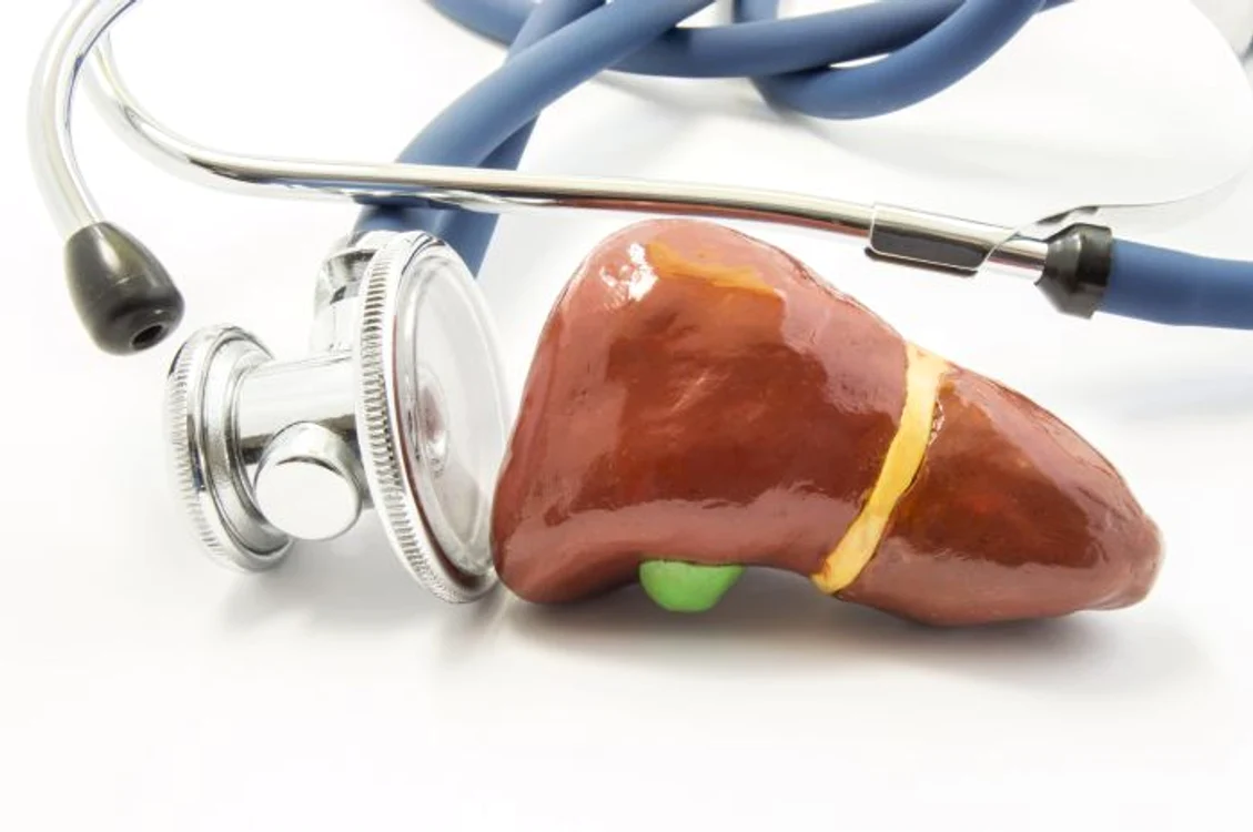 1 fibroza hepatica jpg jpeg