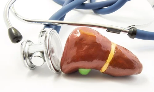 1 fibroza hepatica jpg jpeg