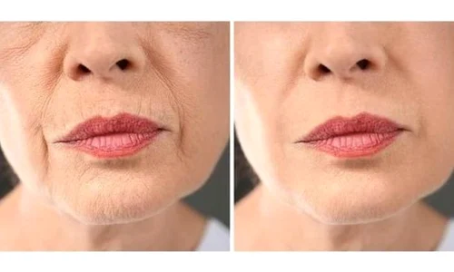 Riduri cod de bare jpg