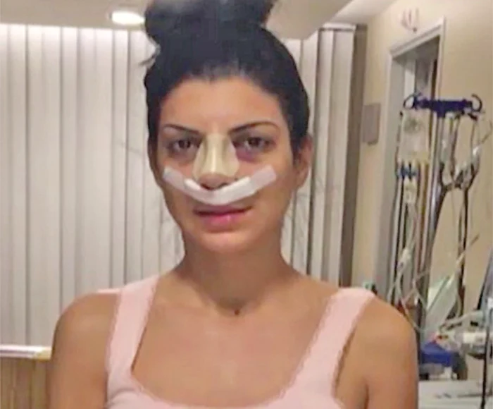 În noiembrie  2014, Andreea  şi-a tăiat nasul 