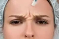 cover Riduri fine sau profunde Află cum Toxina Botulinică poate face minuni jpg