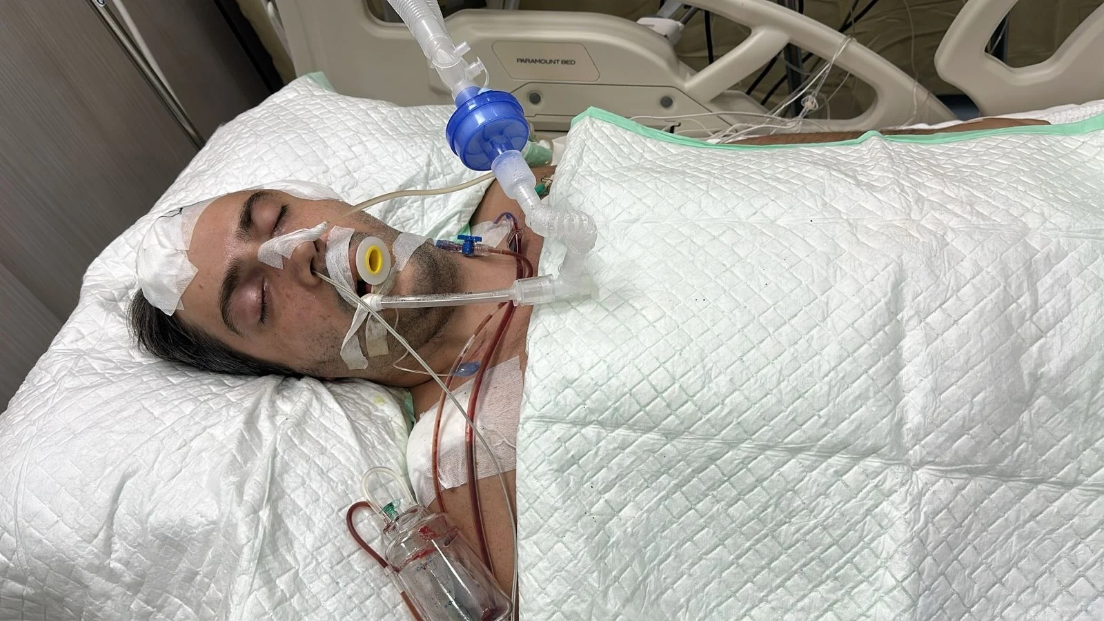 Bărbat din Suceava, în comă după un tragic accident în Indonezia. Spitalizarea sa costă 30.000 de euro