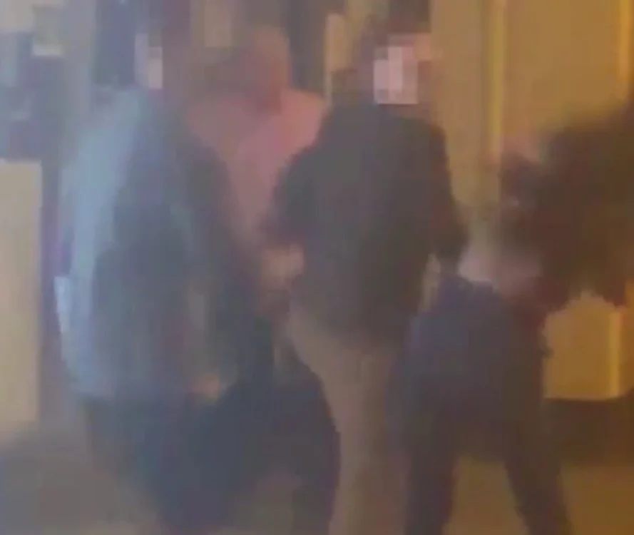 
    Tânăra s-a ales cu fracturi severe și va fi operatăcaptură video  