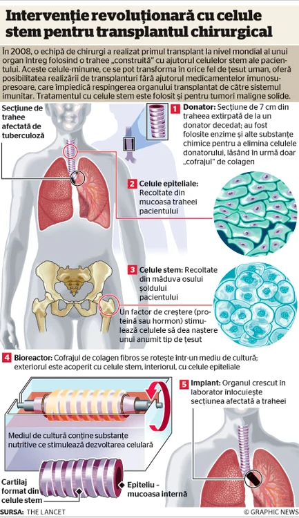 Infografie