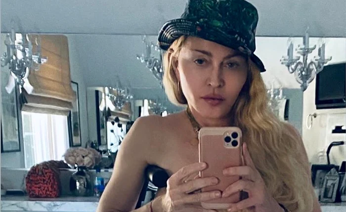 Madonna, la fel de sexy şi când se propteşte-n cârjă
