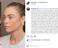 Actrița americană Denise Richards imagini inainte si dupa lifting facial FOTO: Instagram