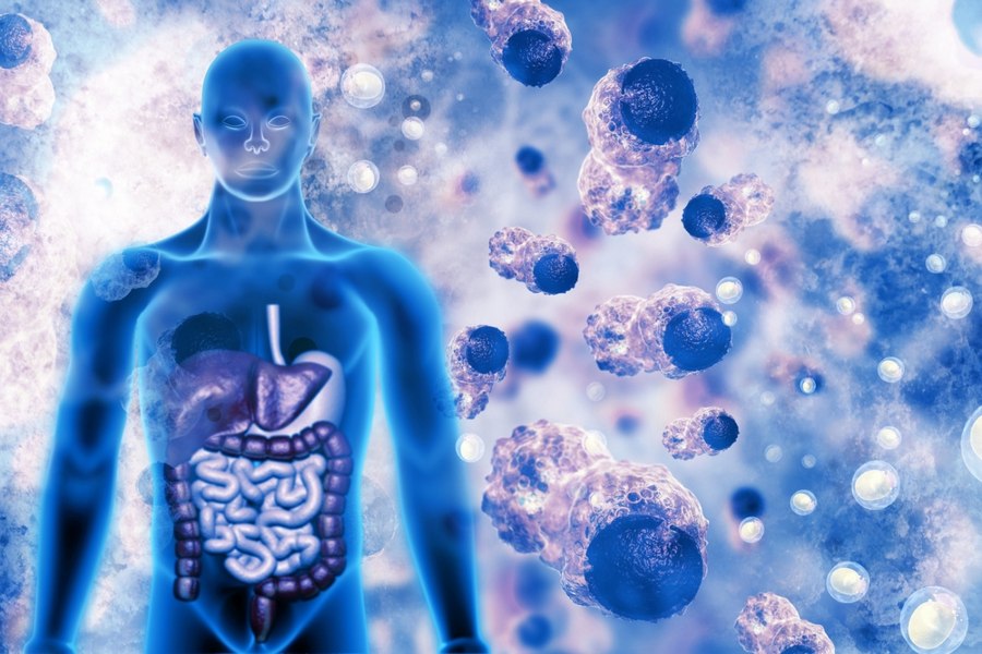 Cancerul afectează din ce în ce mai mult persoanele cu vârste sub 50 de ani: „Dacă simţiţi că ceva nu este în regulă, mergeţi să vă faceţi un control“