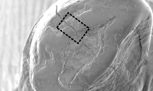 Stomatologie în Epoca de Piatră: a fost descoperită cea mai veche plombă dentară jpeg