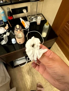 Turiștii români au găsit diverse insecte în camera de hotel