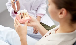 implantul dentar jpeg