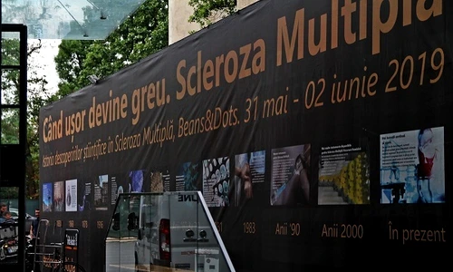 1 scleroza multipla 1 jpg jpeg