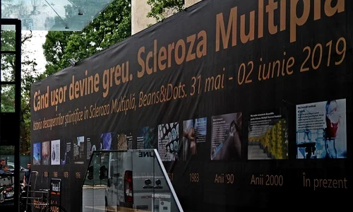 1 scleroza multipla 1 jpg jpeg