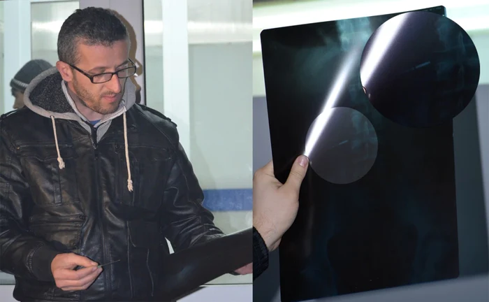 Răzvan Ghibirdic îl acuză pe medicul stomatolog de malpraxis FOTO: Iulian Bunilă
