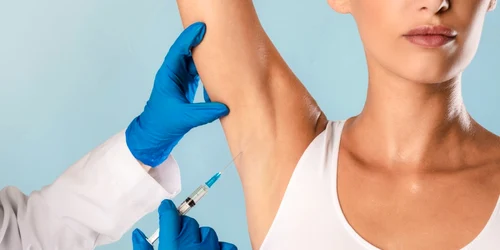 tratament hiperhidroză foto shutterstock