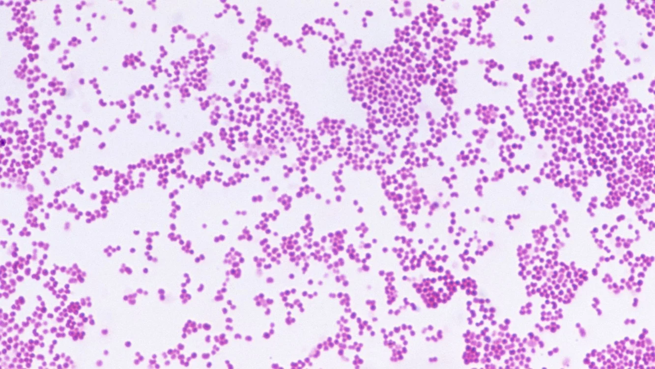 FOTO: CNRI/Science Photo Library