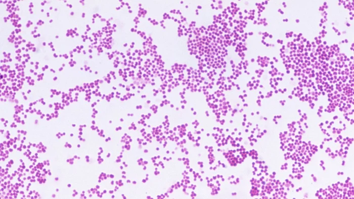 FOTO: CNRI/Science Photo Library