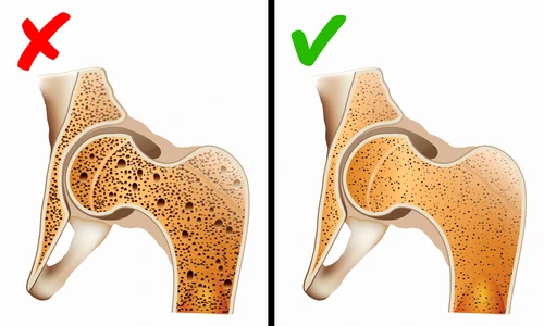 1 ce trebuie sa faci ca sa previi osteoporoza toate femeile trebuie sa stie asta hdp8 jpg jpeg