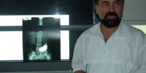 Satu Mare: A scăpat de cuiele din stomac, prin operaţie!