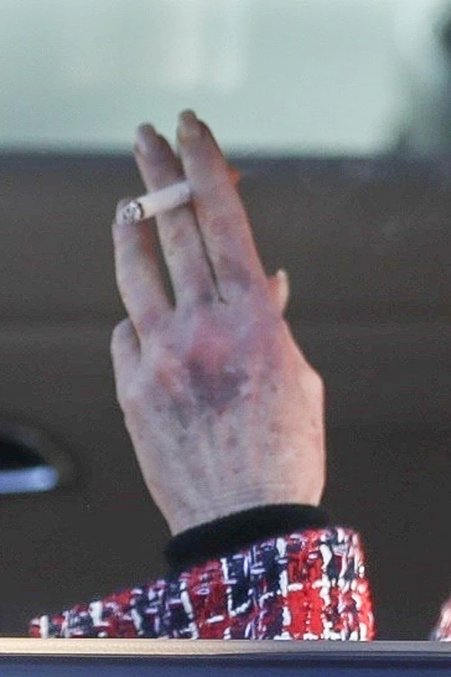 Mâinile actriței arată îngrijorător