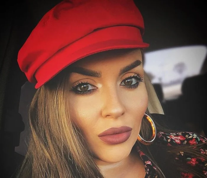 Alin, iubitul Oanei Radu, a suferit arsuri grave pe 75 la sută din suprafaţa corpului Foto: Arhivă personală