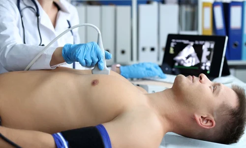 ecografie cardiaca jpg