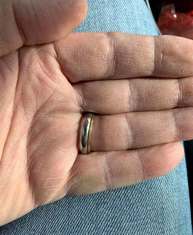 Așa arată mâinile chirurgului Badiu după ce s-a dezinfectat de sute de ori