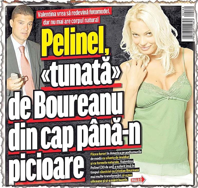 Pelinel şi-a mărit buzele şi bustul
