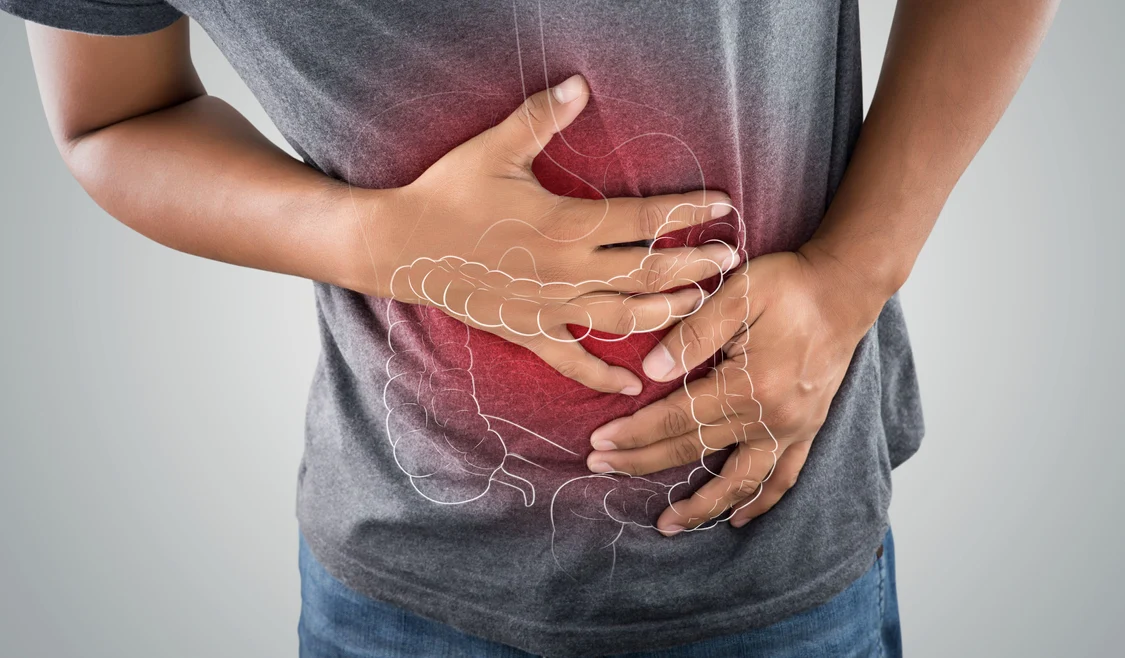 Cancerul de colon, o boală care afectează tot mai mulți români FOTO: Shuterstock