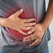 Cancer de colon FOTO Shutterstock jpg