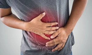 Cancer de colon FOTO Shutterstock jpg