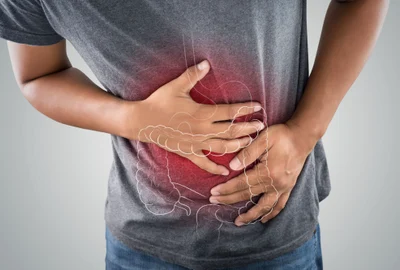 Cancer de colon FOTO Shutterstock jpg