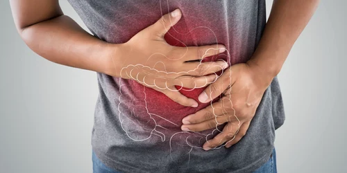 Cancer de colon FOTO Shutterstock jpg