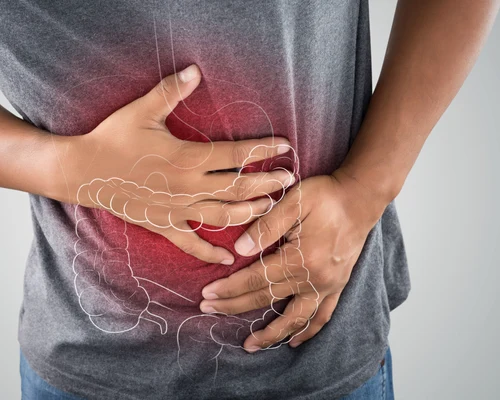 Cancer de colon FOTO Shutterstock jpg